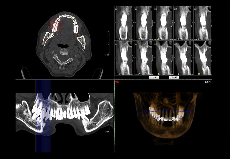  Análisis dental