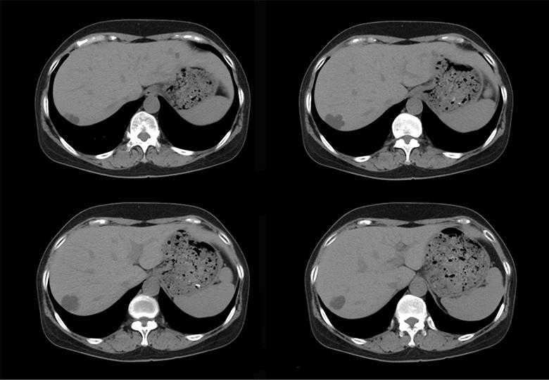 Routine scan (5.0mm)-02