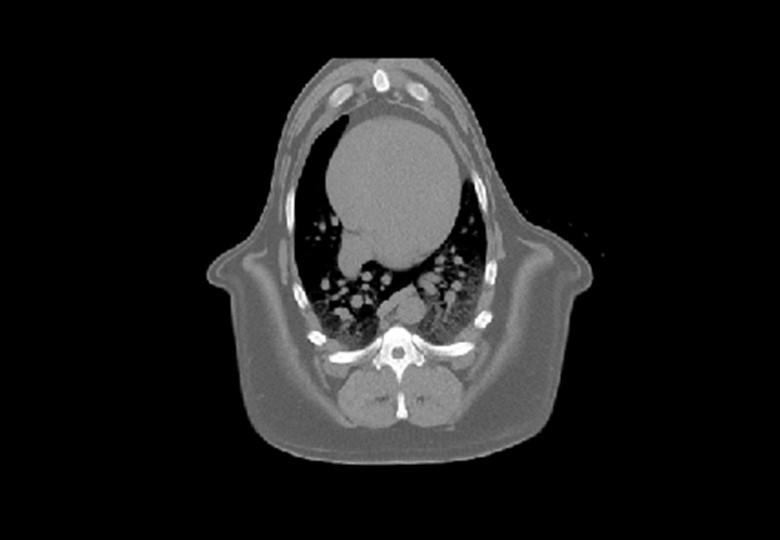 Fenêtre médiastinale