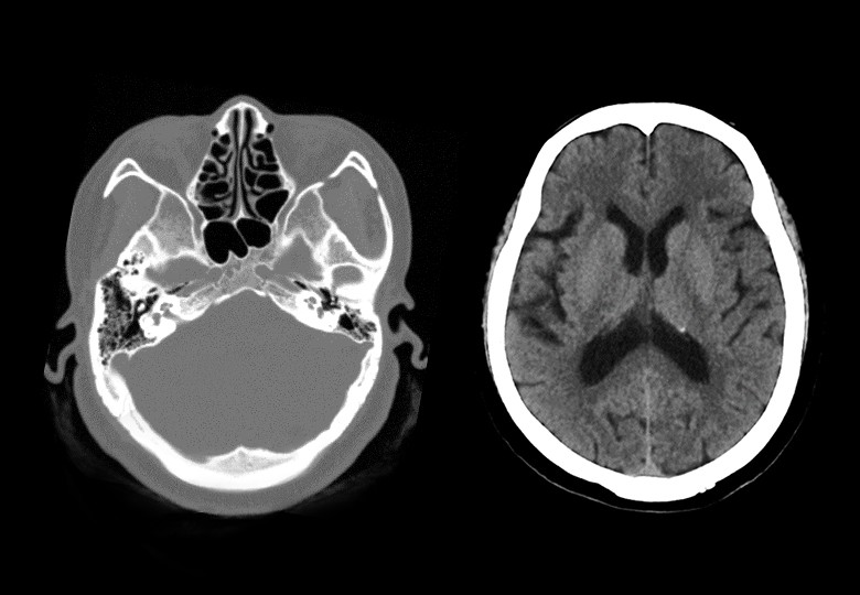 Head Scan