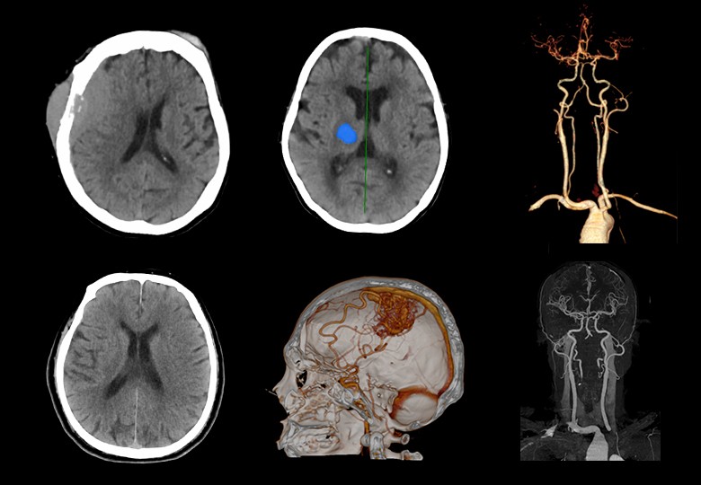 Head Scan