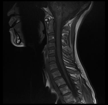 Spine Scan