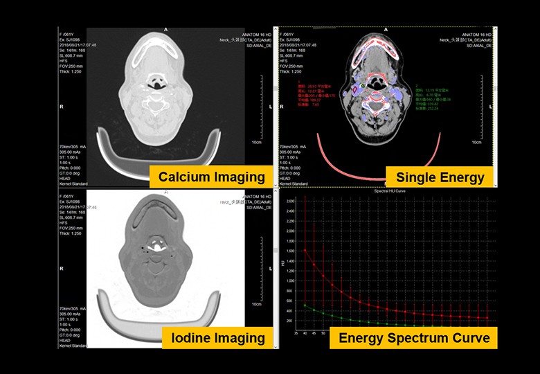 Spectral Scan