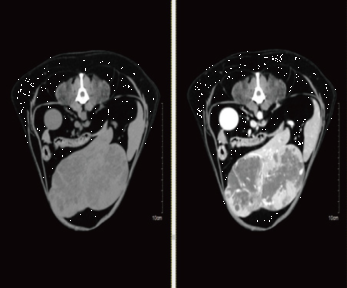 Abdomen Scan