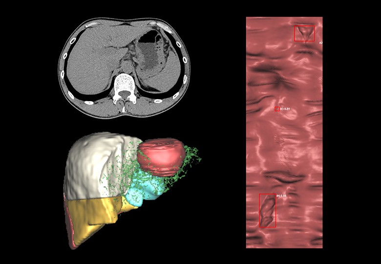 Abdomen Scan