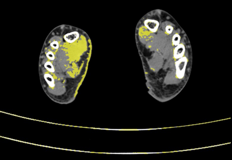 Spectral Scan