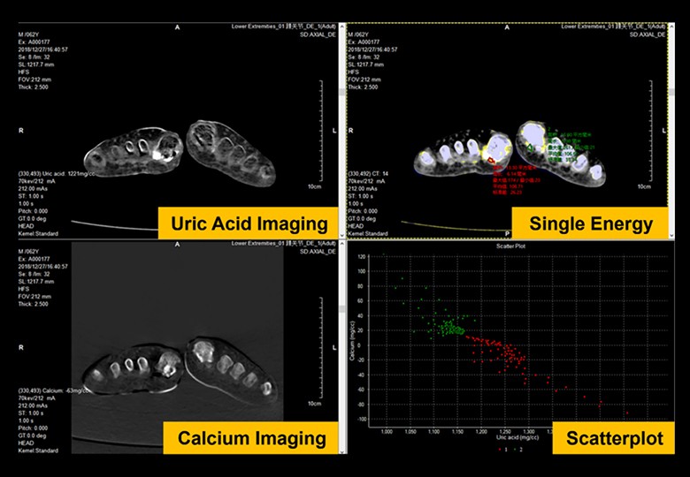 Spectral Scan