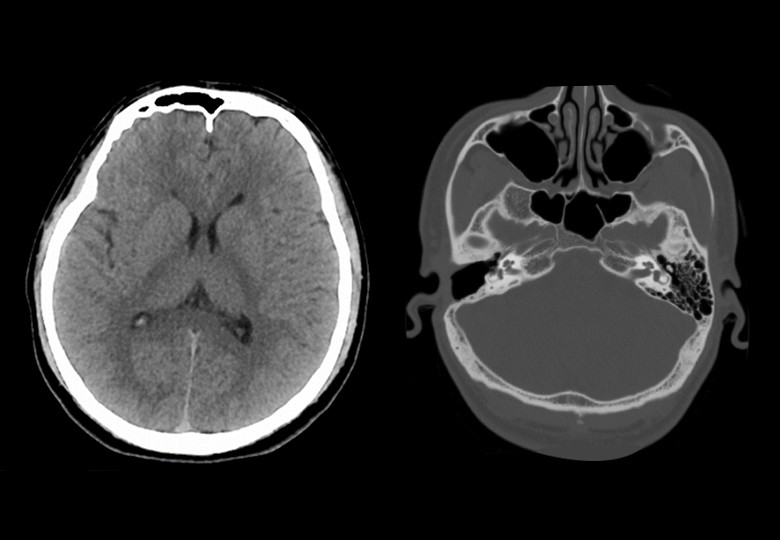 Head Scan