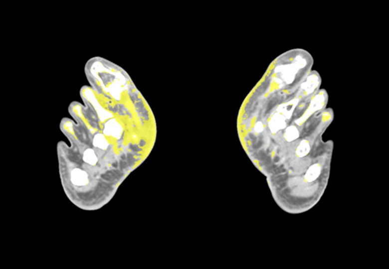 Spectral Scan