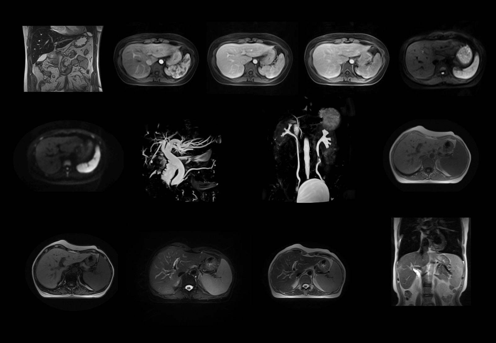 Abdomen Scan