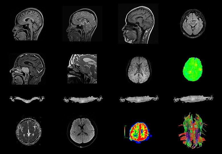 Brain Scan