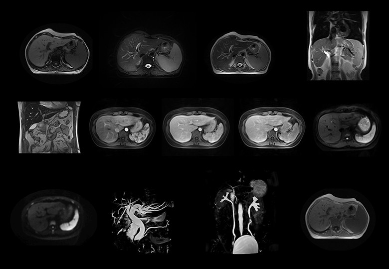 Abdomen Scan